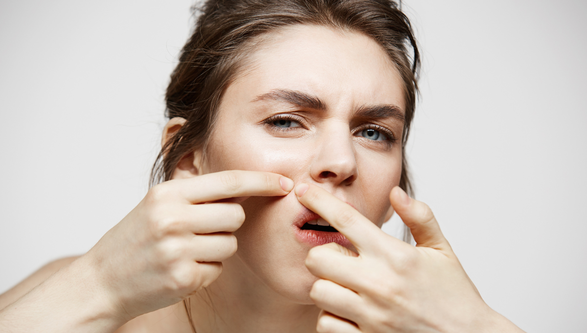 clogged pores