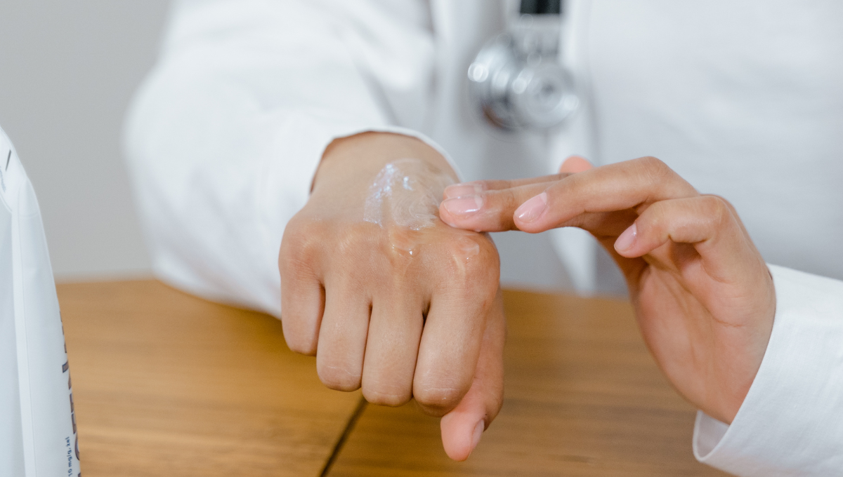 What Causes Hand Eczema? Understanding Triggers