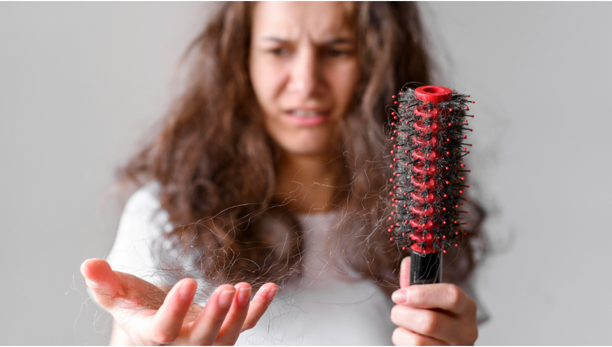 Hormonal Hairfall