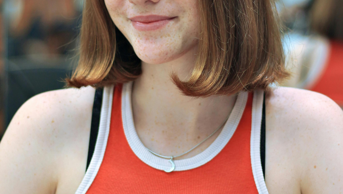 How Puberty Triggers Hormonal Acne