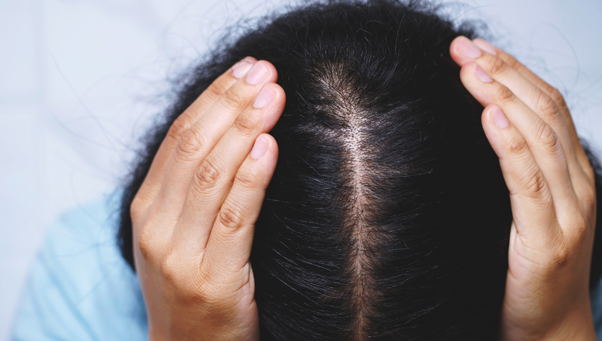 Main Cause of Alopecia Areata