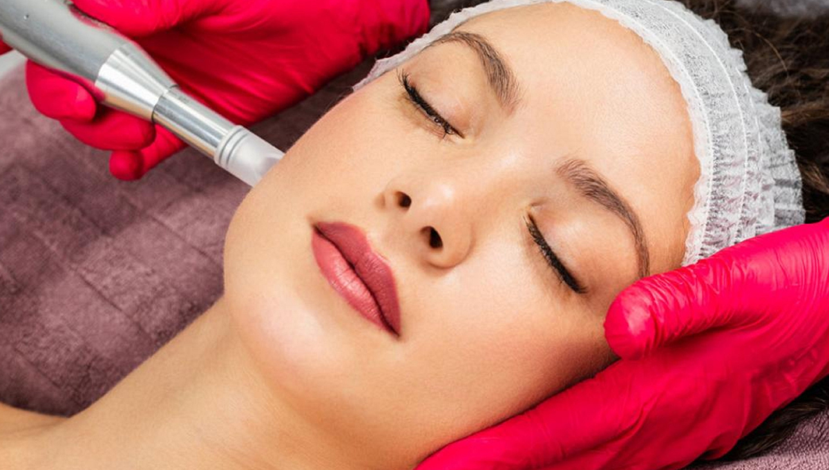 Microneedling Benefits for Skin Health 