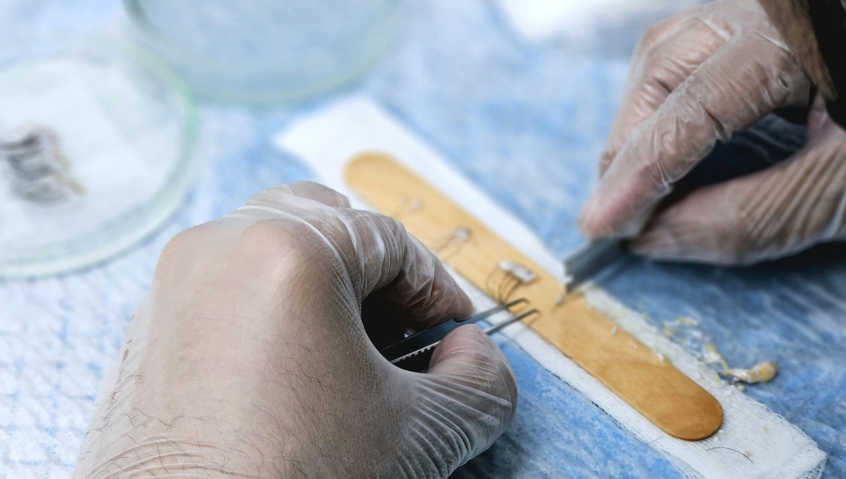 Step-by-Step Guide to Hair Transplants
