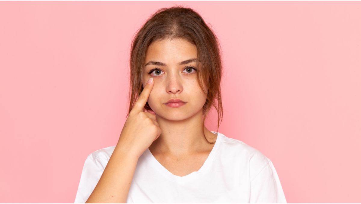 Dark Circles