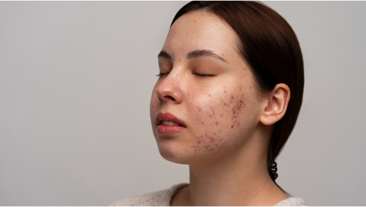 pigmentation 