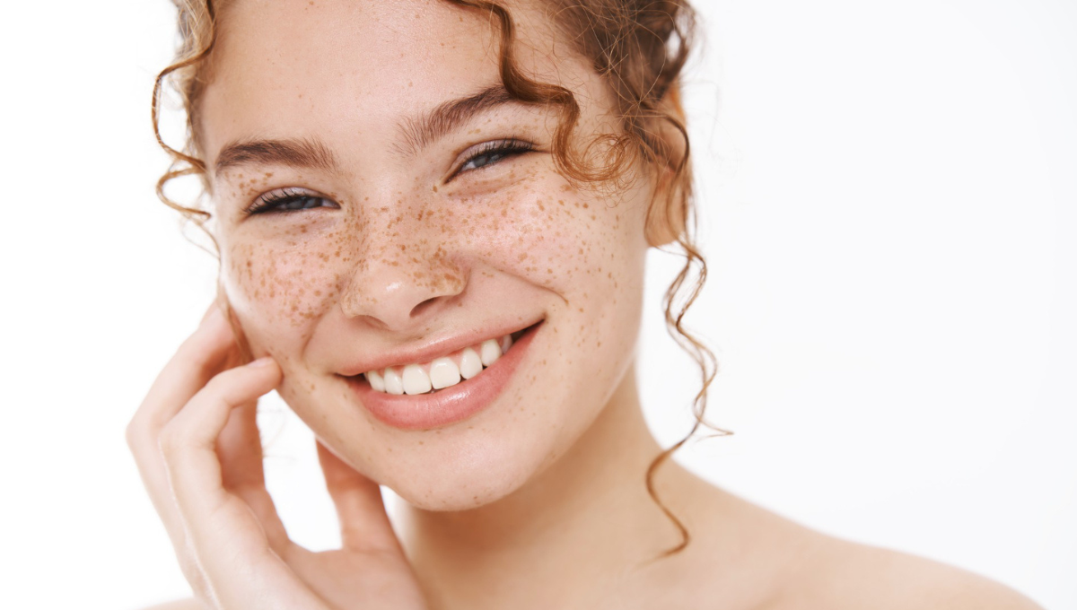 hyperpigmentation