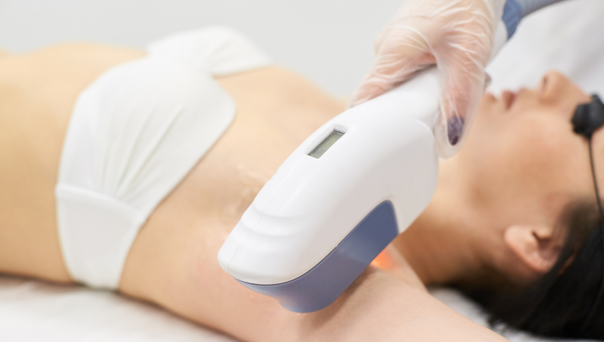 Laser Hair Removal