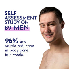 Mannlich 2% Salicylic Acid Body Acne Wash for Men