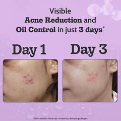 Chemist At Play 2% Salicylic Acid Face Serum