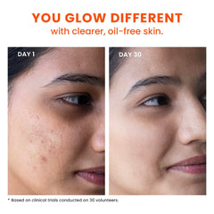 Foxtale 2% Salicylic Acid Face Wash