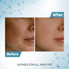 Raaga Professional De-Tan Tan Removal Cream Kojic & Milk