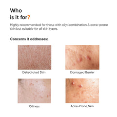Minimalist Dehydrated Skin Moisturizer
