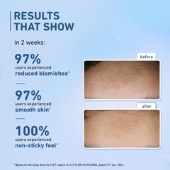 Plum 10% Niacinamide Serum with Rice Water