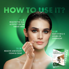 Urban Yog Acne Pimple Patch Facial Kit -72 Dots