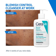 CeraVe Blemish Control Cleanser