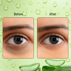 WALVIA Under Eye Patches 