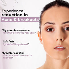 Kaya Clinic Acne Care Purifying Toner with Niacinamide & Witch Hazel