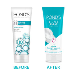 POND's Pimple Clear, Facewash