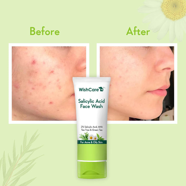 WishCare 2% Salicylic Acid Face Wash for Women & Men with AHA