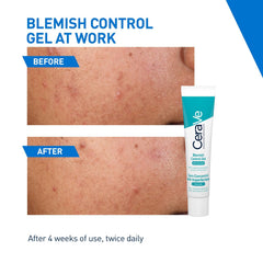 CeraVe Blemish Control Gel with 2% Salicylic Acid and Niacinamide