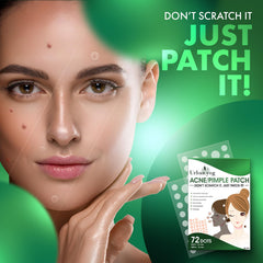 Urban Yog Acne Pimple Patch Facial Kit -72 Dots