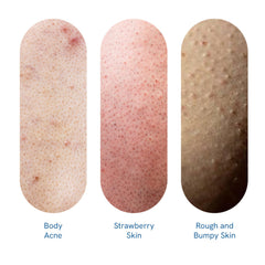 Be Bodywise 1% Salicylic Acid Exfoliating Body Wash