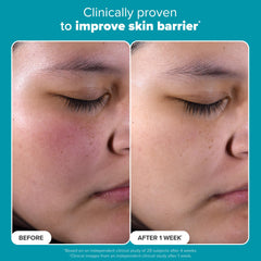 PAULA'S CHOICE SKIN PERFECTING 2% BHA Liquid Salicylic Acid Exfoliant